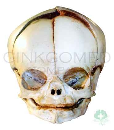 BND0049 Neonatal Skull 