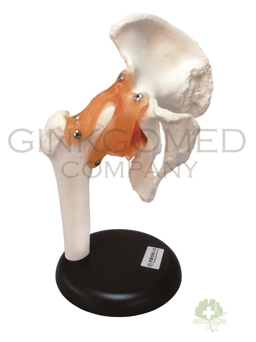 GM-010044 Hip Joint