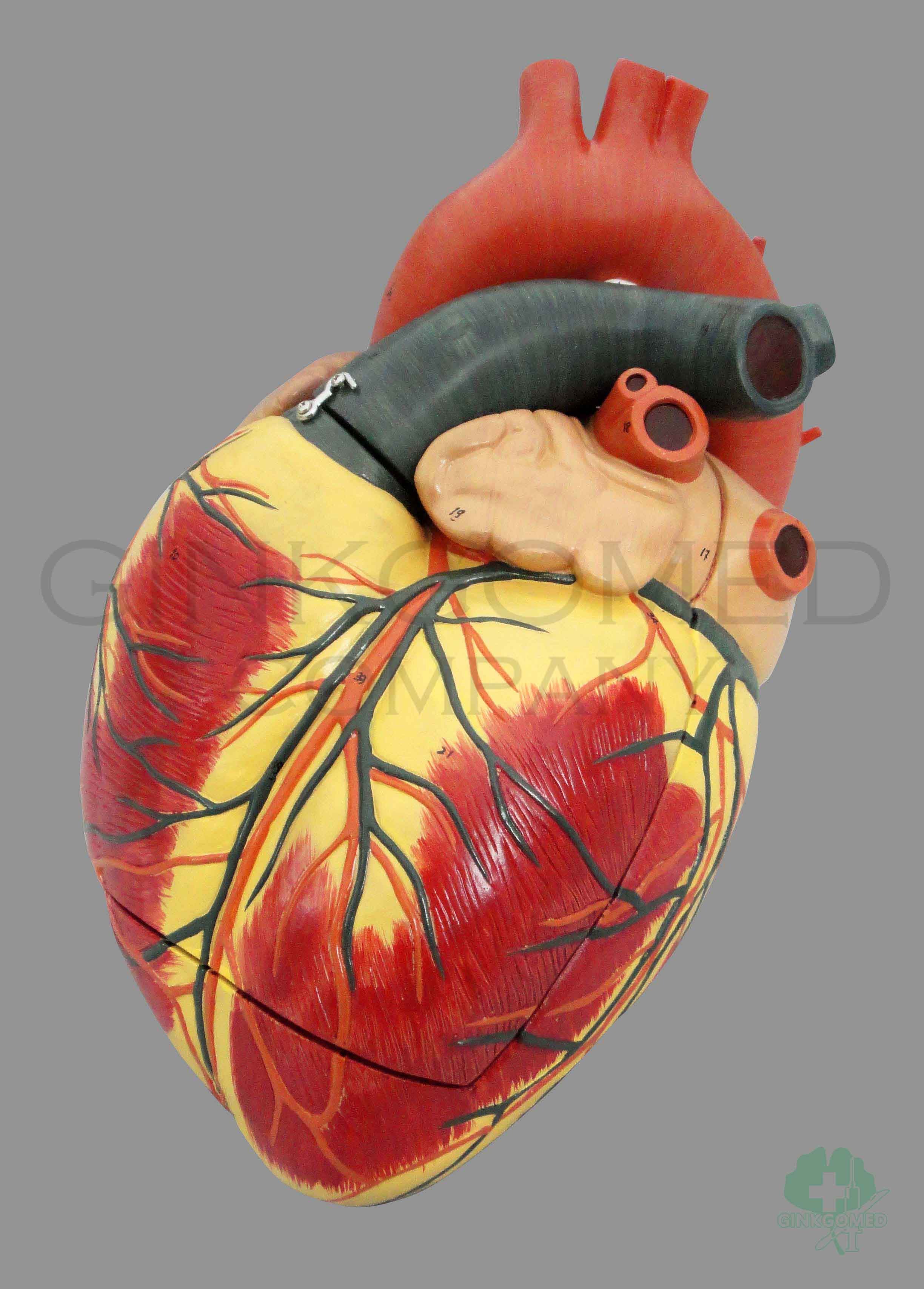 GM-070003  Enlarged Heart