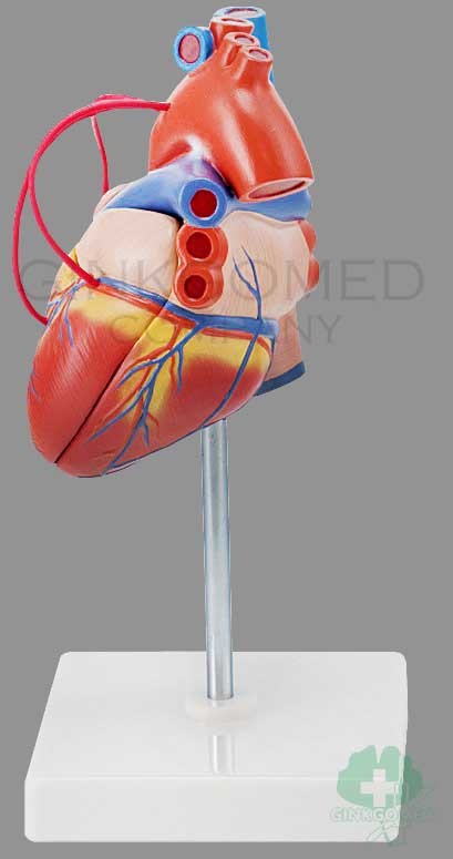 GM-100007  Heart with Bypass