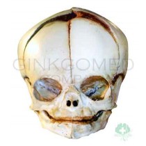 BND0049 Neonatal Skull 