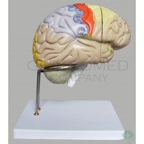 GM-080013  Enlarged Brain