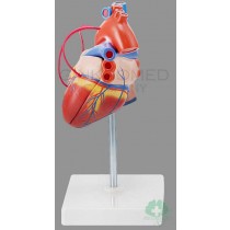GM-100007  Heart with Bypass